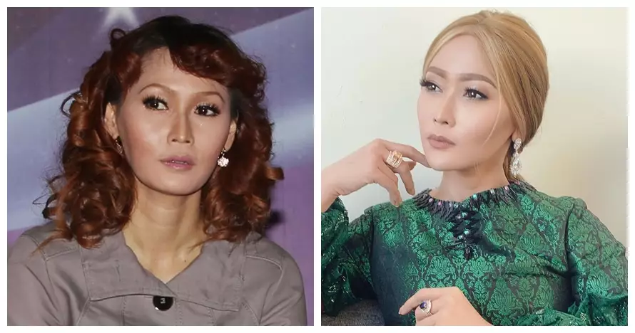 penyanyi tanam benang © 2021 brilio.net