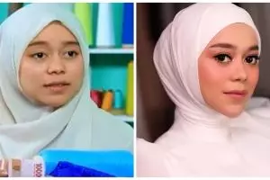 Potret 9 penyanyi sebelum dan sesudah tanam benang, pipi makin tirus
