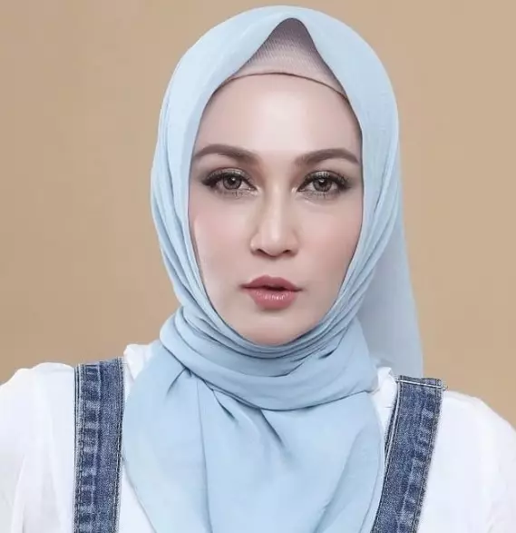 Potret Dina Lorenza usai perawatan tanam benang © Instagram Potret Dina Lorenza usai perawatan tanam benang © Instagram