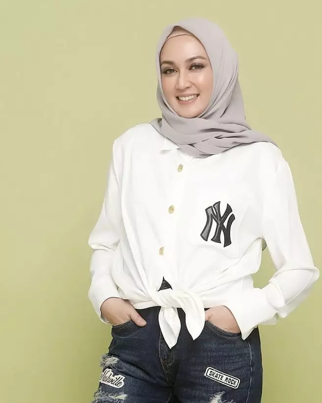 Potret Dina Lorenza usai perawatan tanam benang © Instagram Potret Dina Lorenza usai perawatan tanam benang © Instagram
