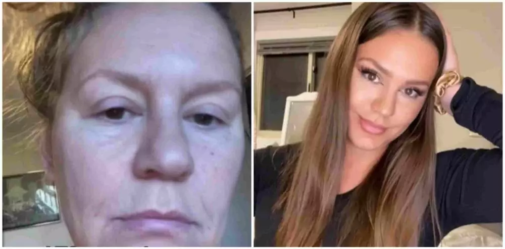 wajah kendur jadi glow up © 2021 brilio.net wajah kendur jadi glow up © 2021 brilio.net