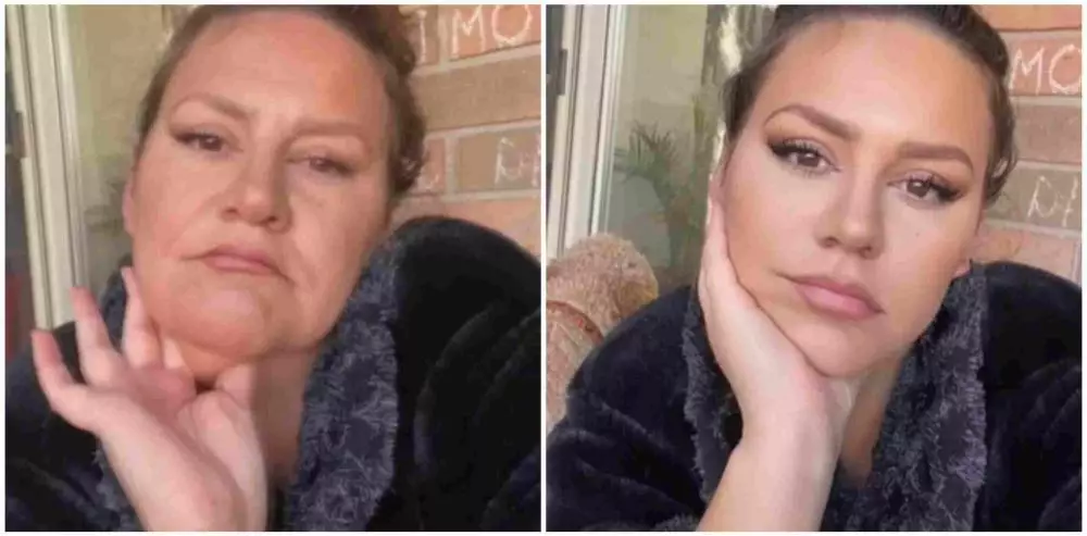 wajah kendur jadi glow up © 2021 brilio.net