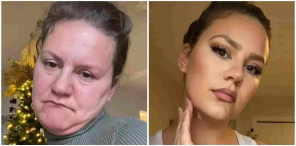 wajah kendur jadi glow up © 2021 brilio.net