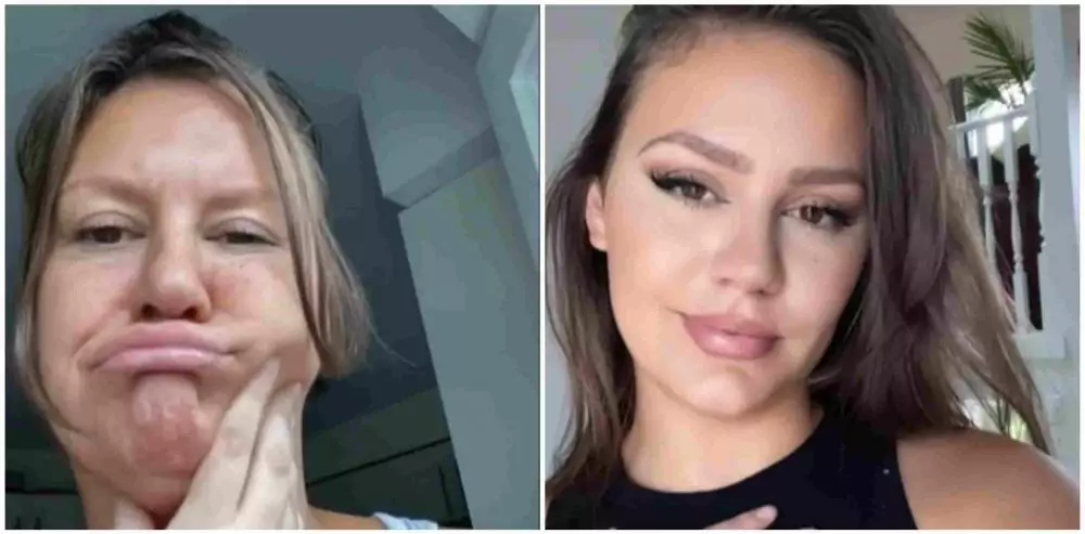 wajah kendur jadi glow up © 2021 brilio.net