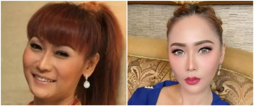 seleb 40-an sebelum dan sesudah tanam benang © berbagai sumber seleb 40-an sebelum dan sesudah tanam benang © berbagai sumber