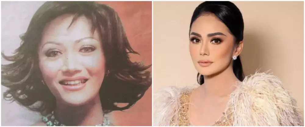 seleb 40-an sebelum dan sesudah tanam benang © berbagai sumber seleb 40-an sebelum dan sesudah tanam benang © berbagai sumber