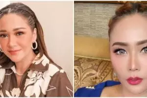 Beda penampilan 9 seleb usia 40-an sebelum dan sesudah tanam benang