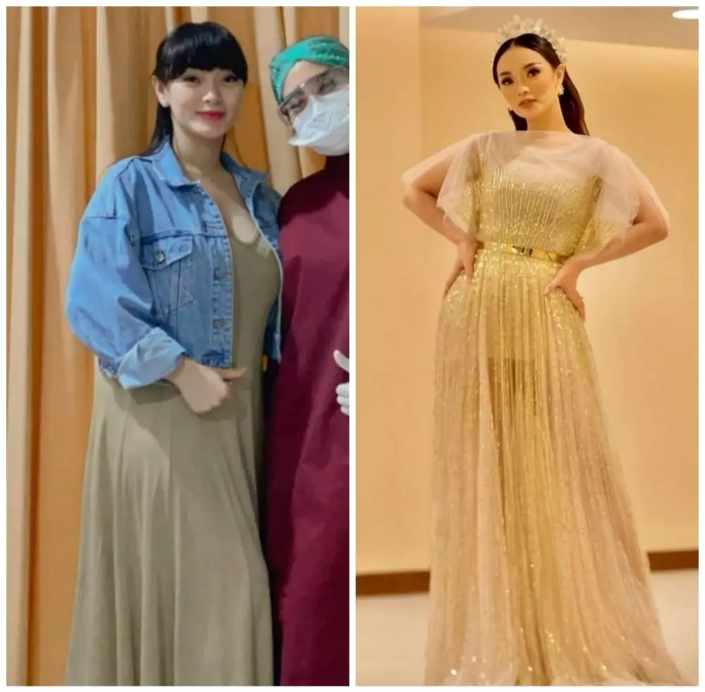 zaskia sebelum dan sesudah diet © 2021 Instagram zaskia sebelum dan sesudah diet © 2021 Instagram