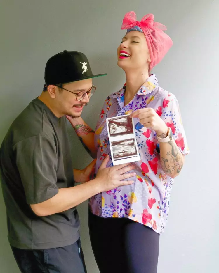 Potret terbaru Derby Romero berbagai sumber