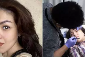 7 Jenis perawatan kecantikan Tina Toon, dari botox hingga sulam bibir