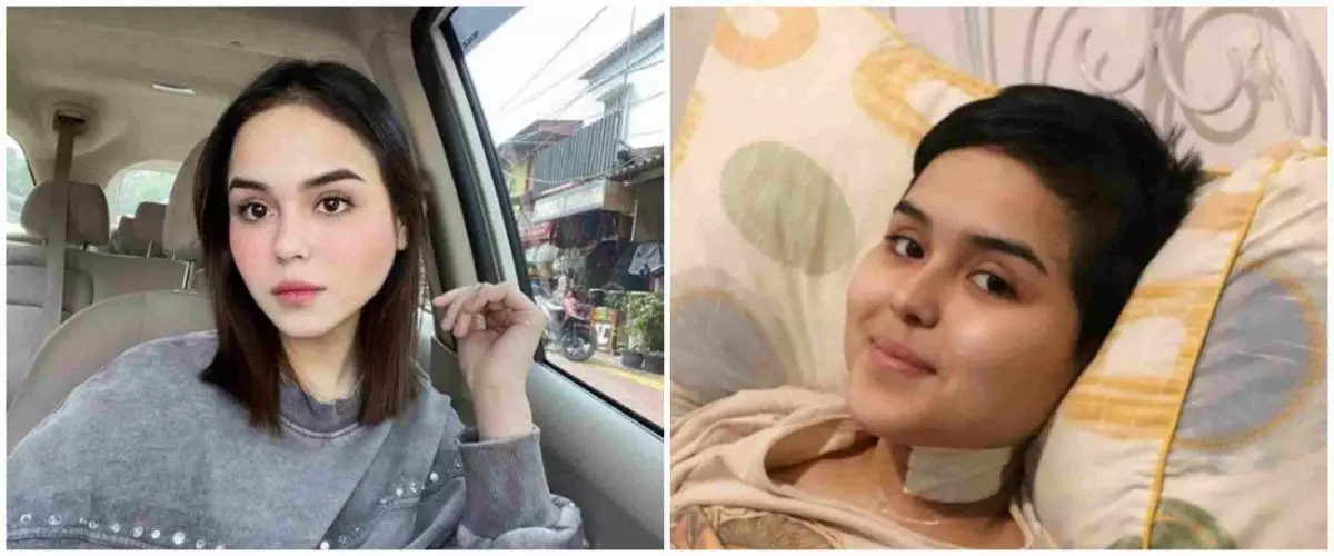 11 Potret Laura Anna selama jalani perawatan, penuh ketabahan