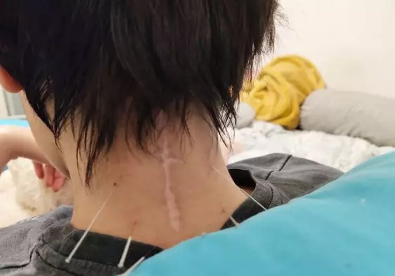 Laura Anna jalani perawatan © 2021 brilio.net Laura Anna jalani perawatan © 2021 brilio.net