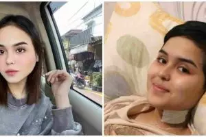 11 Potret Laura Anna selama jalani perawatan, penuh ketabahan