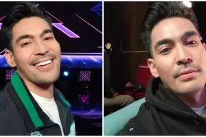 Dibawa ke rumah sakit usai terjatuh, begini kondisi Robby Purba