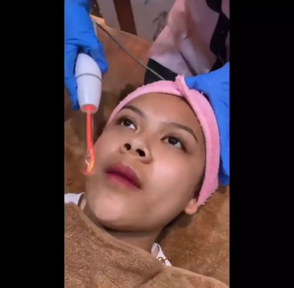 Perawatan kecantikan Meli LIDA Instagram