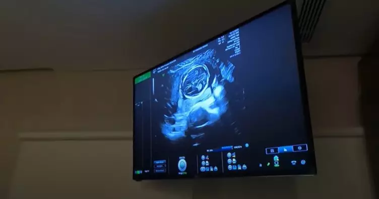 Momen Nikita Willy cek kandungan © 2021 YouTube