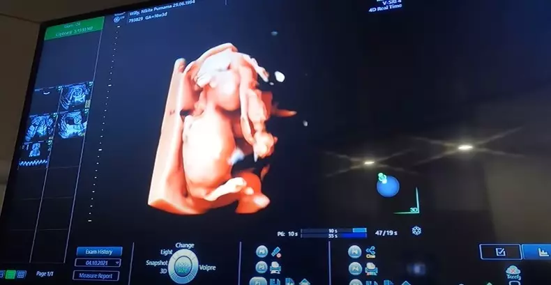 Momen Nikita Willy cek kandungan © 2021 YouTube