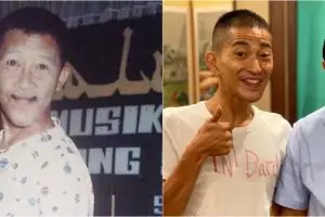 11 Transformasi Bio One jadi Gepeng Srimulat, bikin pangling