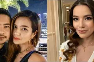 Bukan KDRT, ini penyebab luka lebam di mata Sheila Marcia