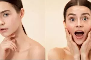 9 Daun penghilang flek hitam di wajah dan cara menggunakannya