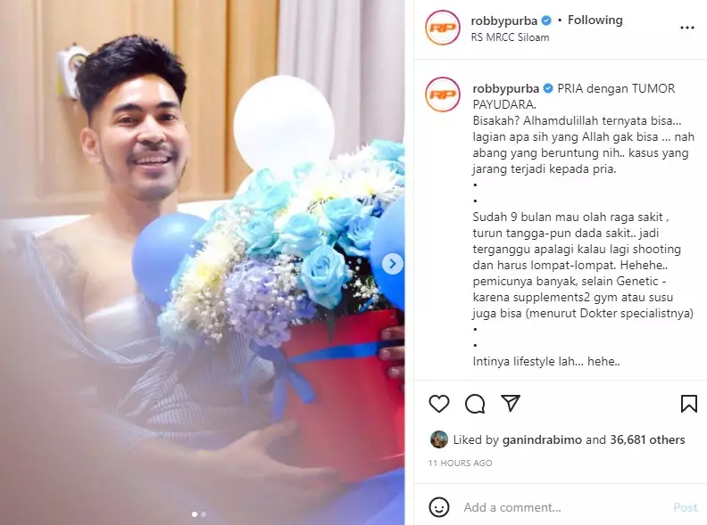 Robby Purba tumor payudara © 2021 Instagram