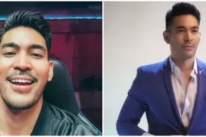 Robby Purba alami tumor payudara, jalani operasi pengangkatan