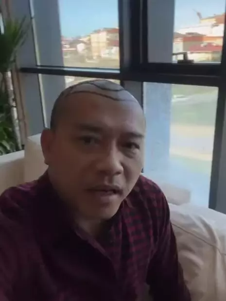 Potret Anang Hermansyah tampil botak © berbagai sumber