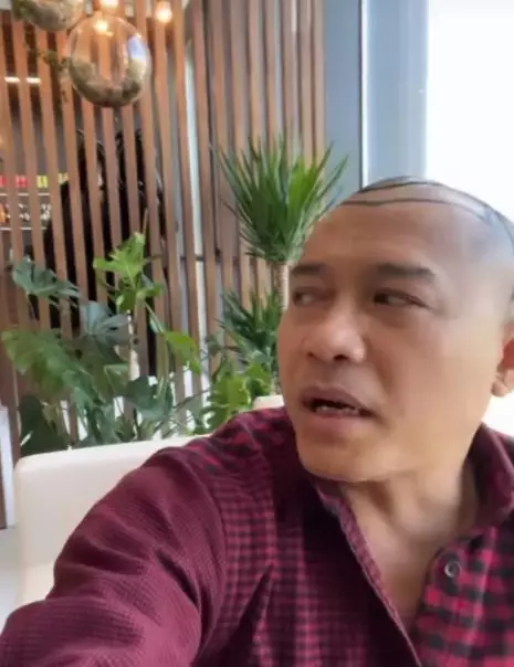 Potret Anang Hermansyah tampil botak © berbagai sumber