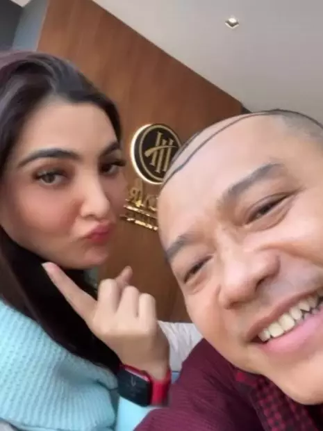 Potret Anang Hermansyah tampil botak © berbagai sumber