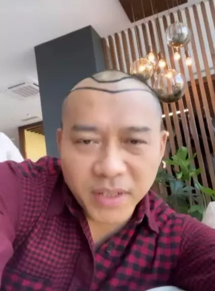 Potret Anang Hermansyah tampil botak © berbagai sumber