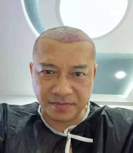 Potret Anang Hermansyah tampil botak © berbagai sumber