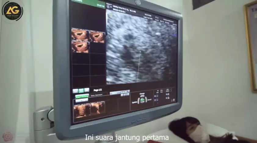 momen Adiezty dan Gilang Dirga cek kandungan © YouTube momen Adiezty dan Gilang Dirga cek kandungan © YouTube