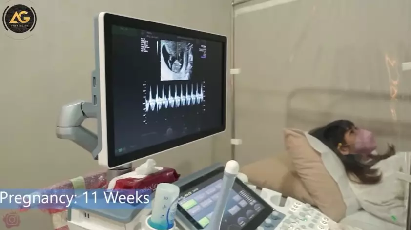 momen Adiezty dan Gilang Dirga cek kandungan © YouTube momen Adiezty dan Gilang Dirga cek kandungan © YouTube