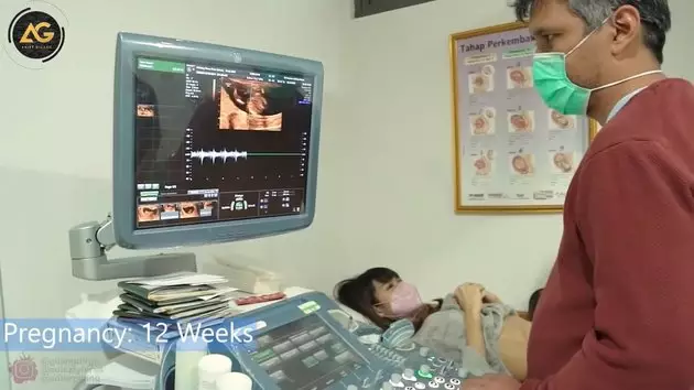 momen Adiezty dan Gilang Dirga cek kandungan © YouTube momen Adiezty dan Gilang Dirga cek kandungan © YouTube