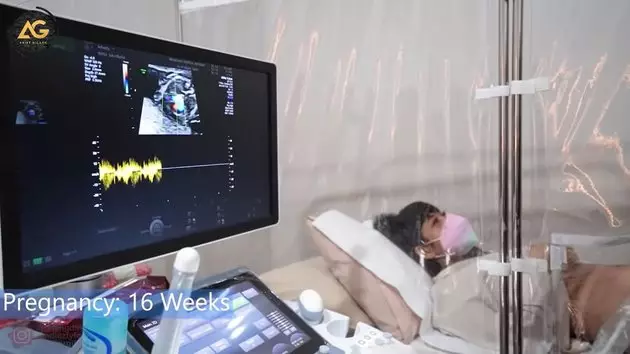 momen Adiezty dan Gilang Dirga cek kandungan © YouTube momen Adiezty dan Gilang Dirga cek kandungan © YouTube