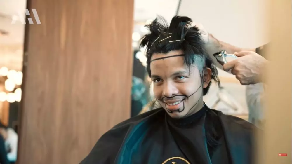 Tak pede berjidat lebar, 9 potret Atta Halilintar transplantasi rambut berbagai sumber