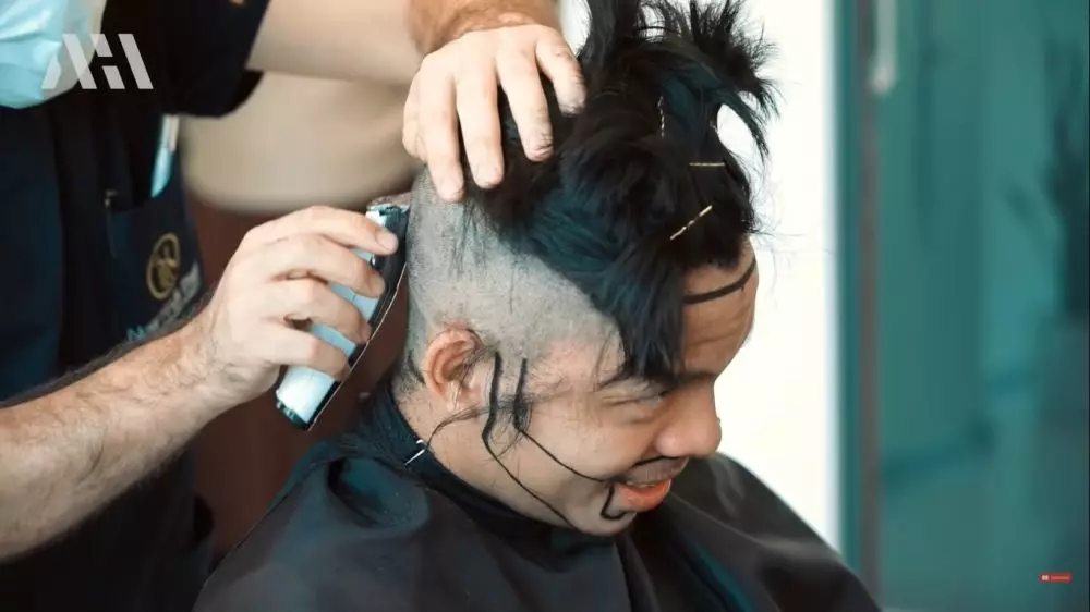 Tak pede berjidat lebar, 9 potret Atta Halilintar transplantasi rambut berbagai sumber