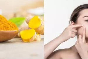 10 Manfaat kunyit untuk wajah, mampu atasi jerawat