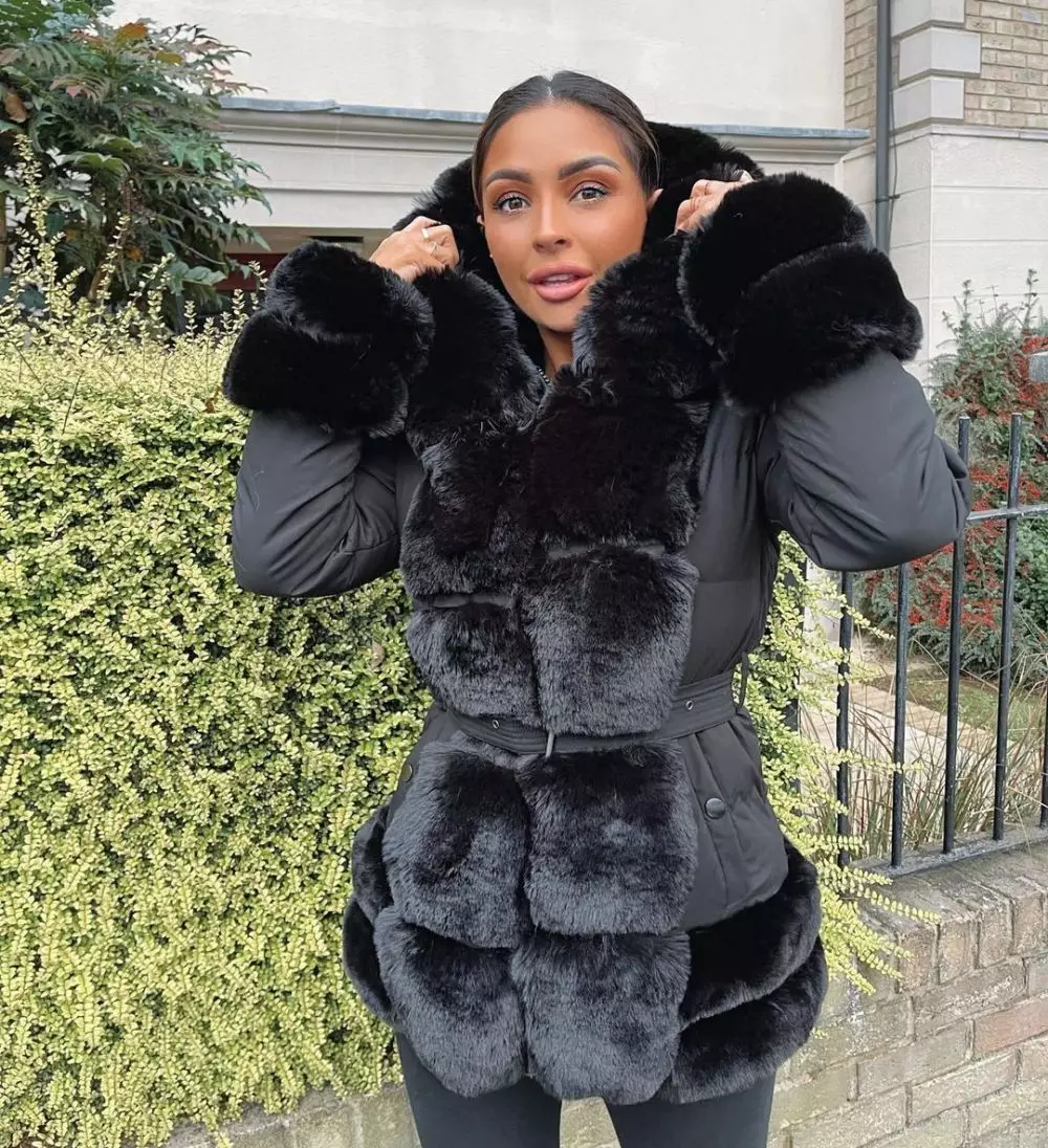 Wanita menderita trichotillomania butuh bulu mata palsu Instagram