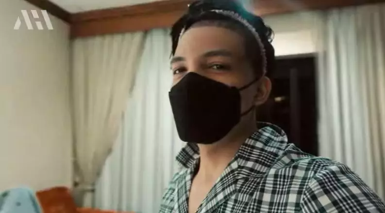 Atta Halilintar usai transplantasi rambut Berbagai sumber