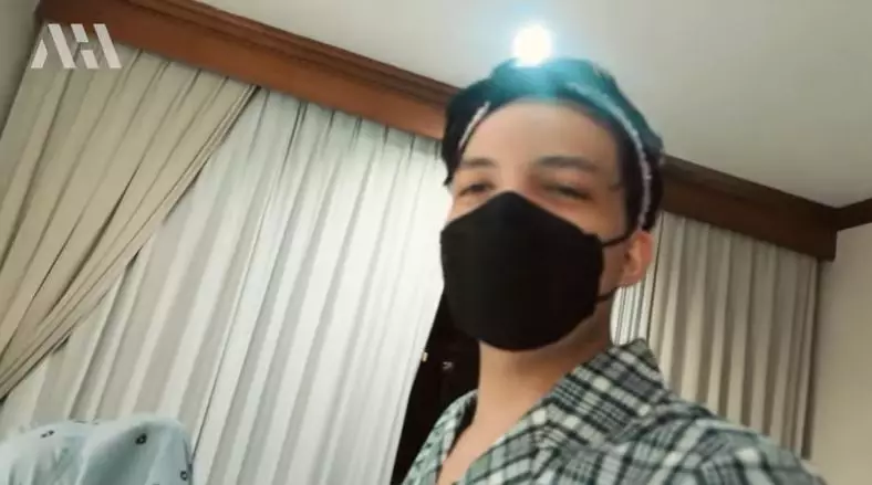 Atta Halilintar usai transplantasi rambut Berbagai sumber