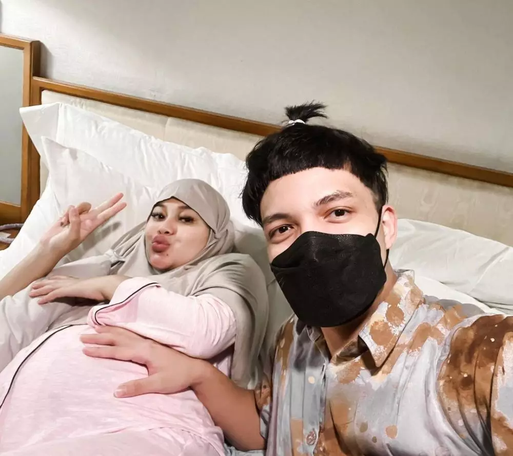 Atta Halilintar usai transplantasi rambut Berbagai sumber