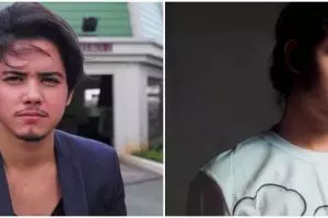 Kisah perjuangan Aliando sembuh dari gangguan mental OCD ekstrem