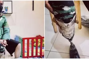 Kisah haru driver ojek online difabel, bikin kaki palsu dari knalpot