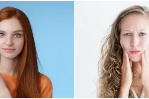 11 Rekomendasi skincare remaja untuk kulit kering, wajah bebas kusam