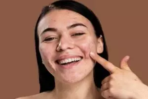 16 Rekomendasi skincare kulit berjerawat dan berminyak harga mulai Rp 25 ribu, wajah mulus bebas kilau