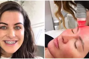 Mengenal setrika wajah, manfaat, dan efeknya untuk kulit