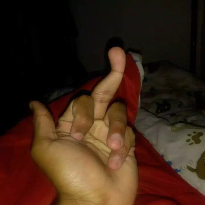 penampakan nyeleneh bagian tubuh manusia © berbagai sumber