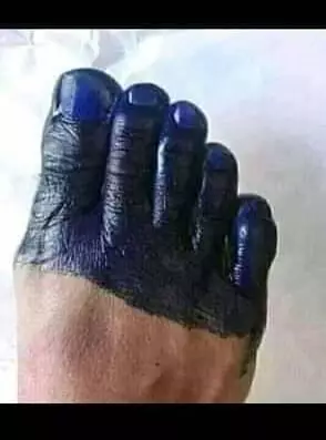 penampakan nyeleneh bagian tubuh manusia © berbagai sumber