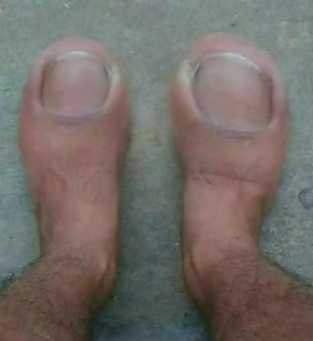 penampakan nyeleneh bagian tubuh manusia © berbagai sumber